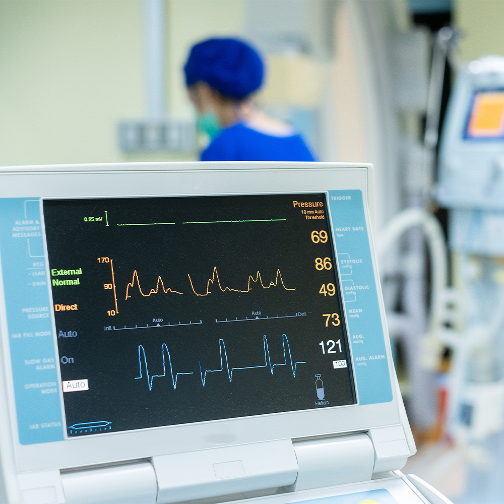EKG(Elektrokardiyografi)