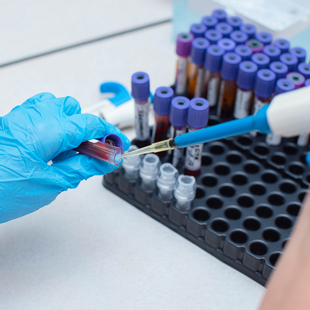 Hematoloji Testleri